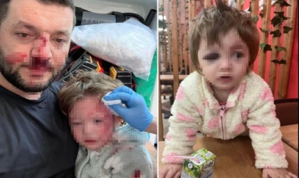 İkra Bebek ve Babasını Kanlar İçinde Bırakmıştı! Skuterli Saldırgana Rekor Ceza İstemi: Tam 36 Yıl!